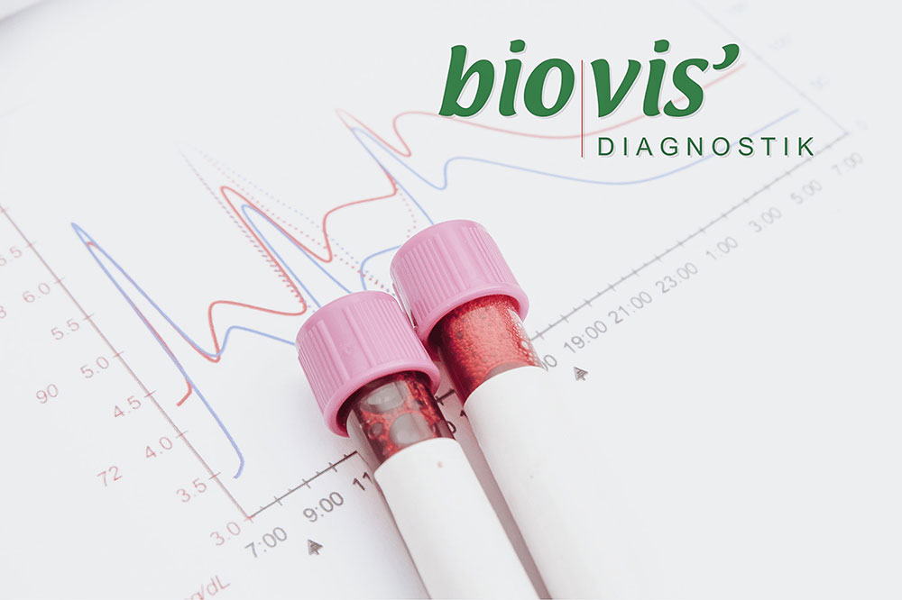 biovis Labordiagnostik zur ganzheitlichen Gesundheits- und Ernährungsberatung Hamburg Die Werbeschmiede, Rosacea ganzheitlich behandeln mit dem Rosacea Hautcoaching Rosacea adé