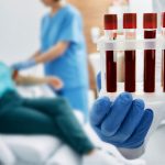 Diese Entzündungsmarker sind bei Rosacea erhöht. Aktuelle Studienlage. Claudia Rönsch, die Glückstrainerin, ganzheitliche Gesundheits- & Ernährungsberaterin, Hamburg